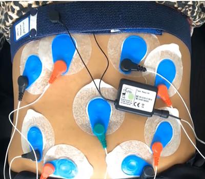 Changes in the autonomic cardiorespiratory activity in parturient women with severe and moderate features of preeclampsia